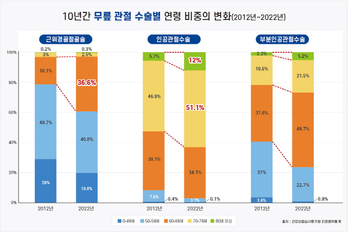 관절염으로 변형된 '오다리', 교정술 필요한 이유는?