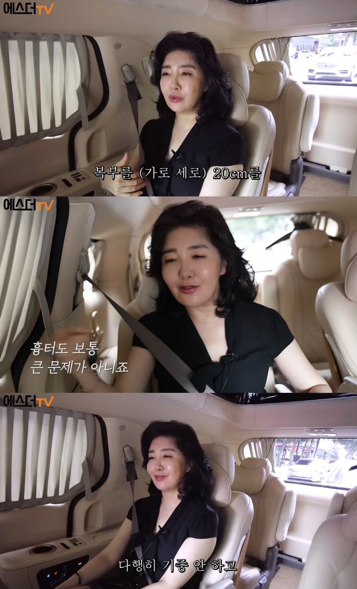 여에스더 “동생, 간염으로 사망 위기..내가 간 이식하려 했었다”