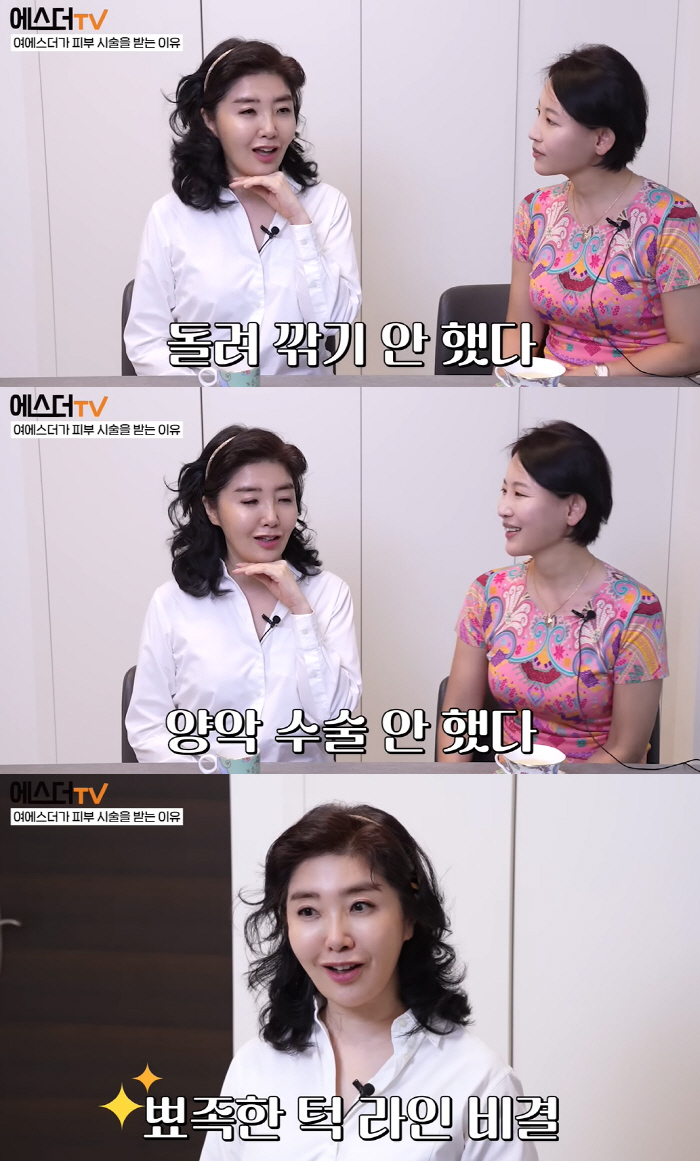 여에스더, 성형 의혹 해명 “양악·돌려깎기 안했다..꾸준한 시술로 예뻐진…