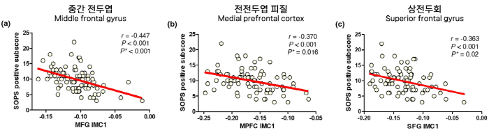 "조현병 고위험 환자 미세한 뇌조직 변화 확인"…조기진단 가능성 열려