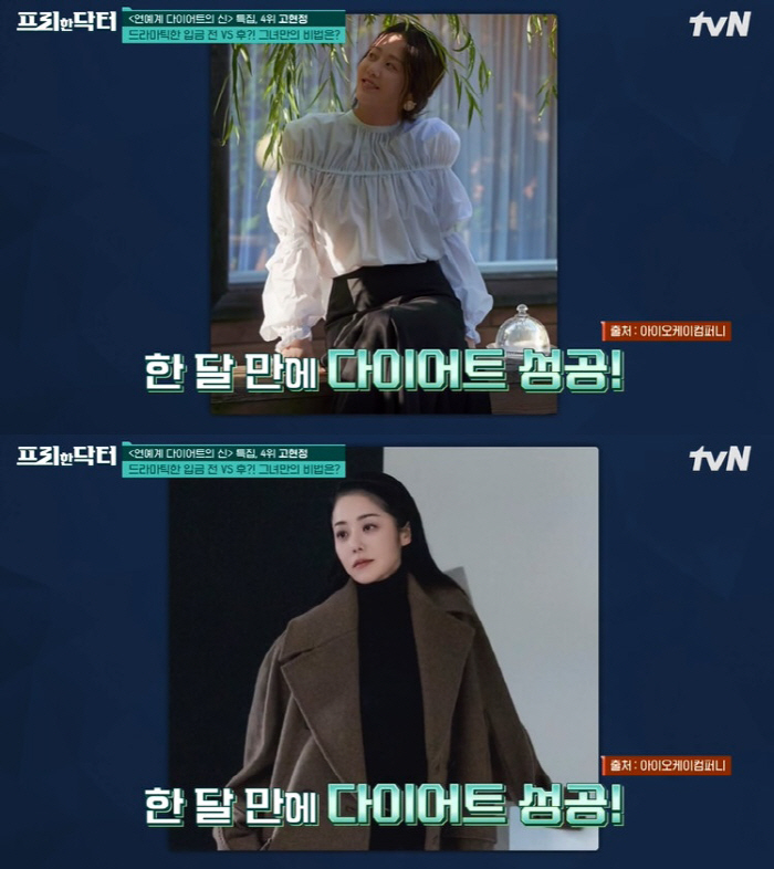 "수염 기르고 다이어트하고" 조인성→고현정까지, 충격의 입금 전후 ★ […