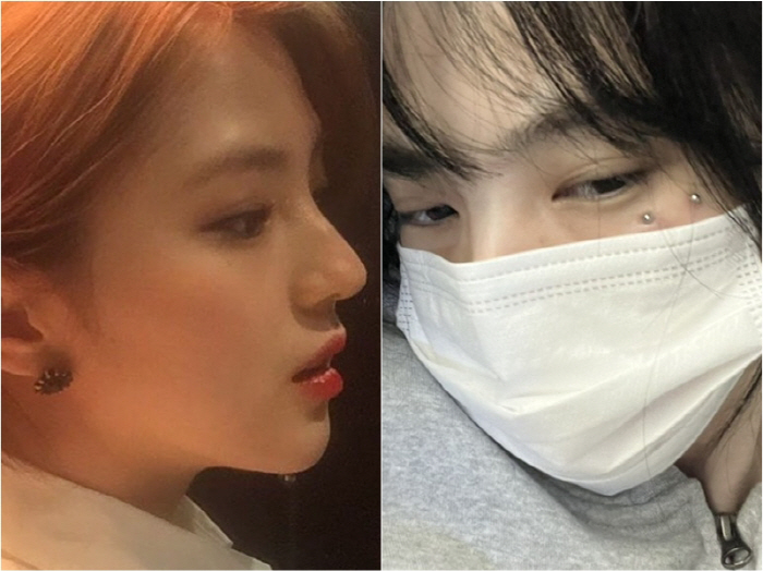 "드디어 비염수술 했습니다"…한소희 "난데없는 코골이로 스트레스, 저질러…