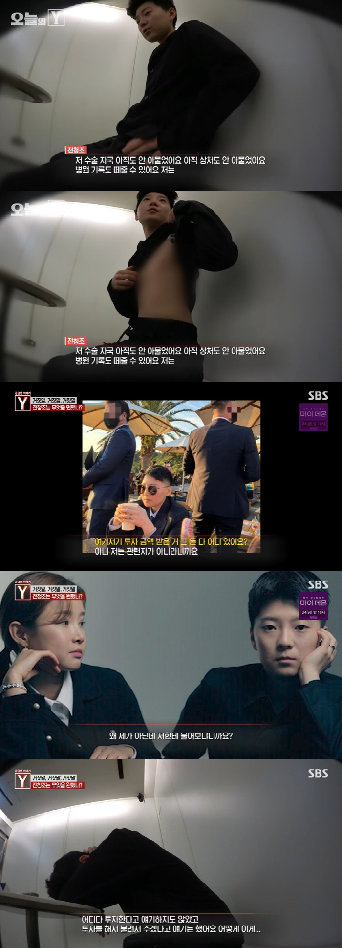 전청조, 가슴 제거 자국 공개→"나 전청조 아냐" 거짓말…혼돈의 인터뷰 …