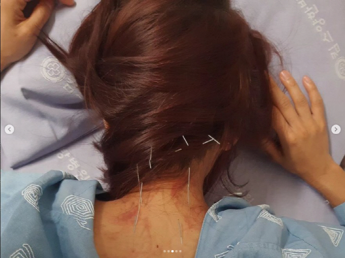 조민아, 子 등원길에 교통사고 "아들 뇌진탕 증세로 12번 토해, 마음 …