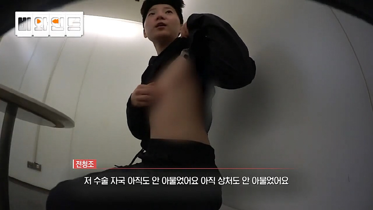 "男화장실 가더라. 흉터 가까이서 못봐"…'궁금한이야기Y' PD가 전하는…