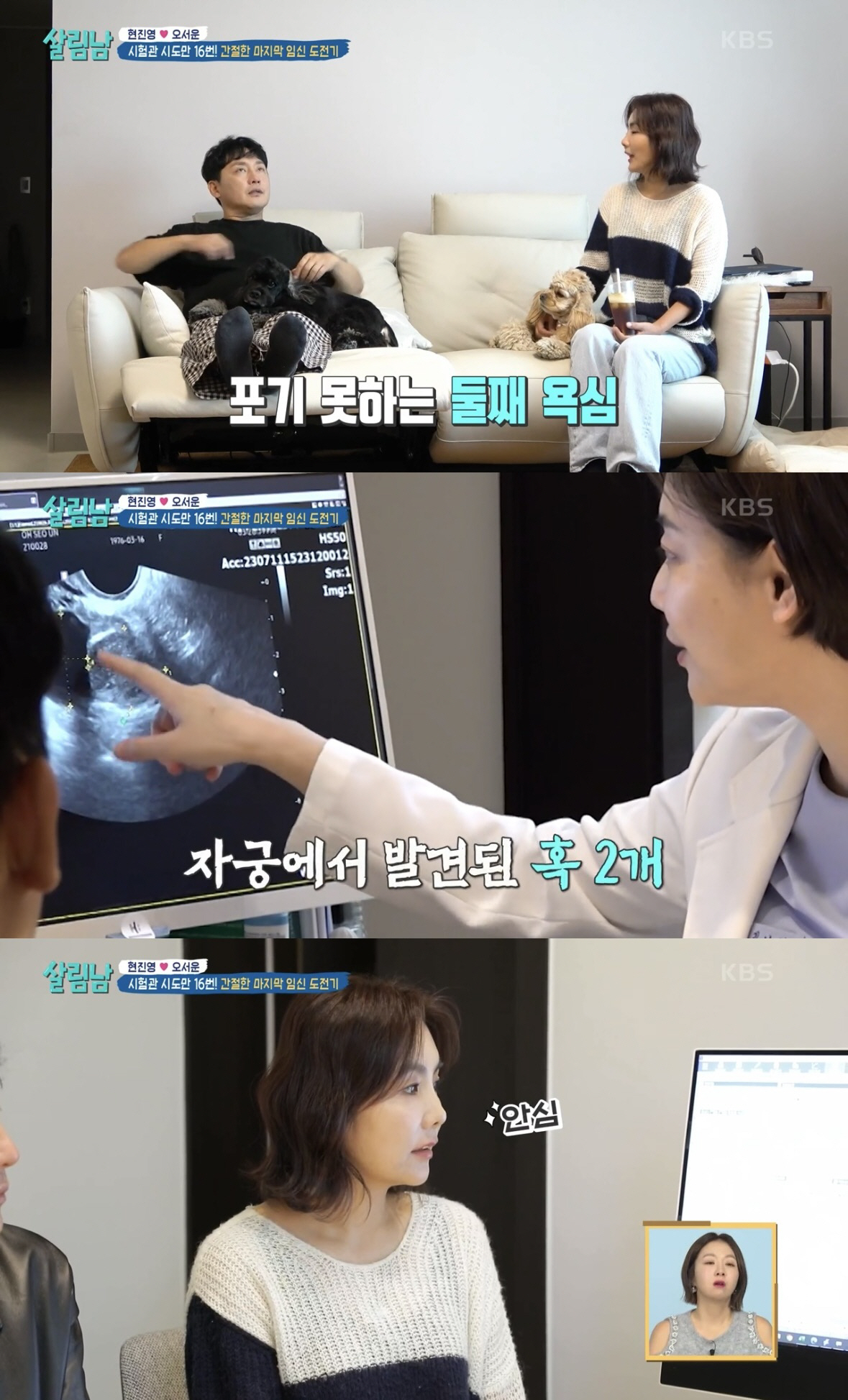 [SC리뷰] '7㎏감량+금연' 현진영, 정자 운동성↑에 "한다면 하는 사…