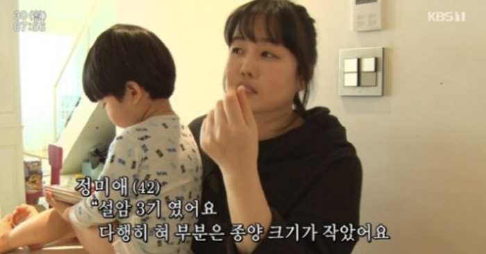 "가슴이 철렁" 이정→윤도현, 뒤늦게 털어놓은 암투병 극복기…쏟아지는 응…