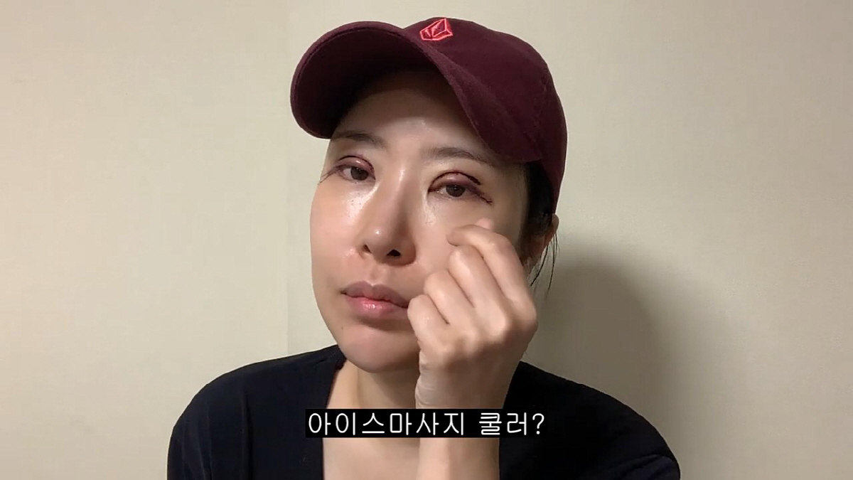 이세영, 쌍꺼풀 재수술 "몇번 했는데 떨려..코수술보다 더 아파"('영평…