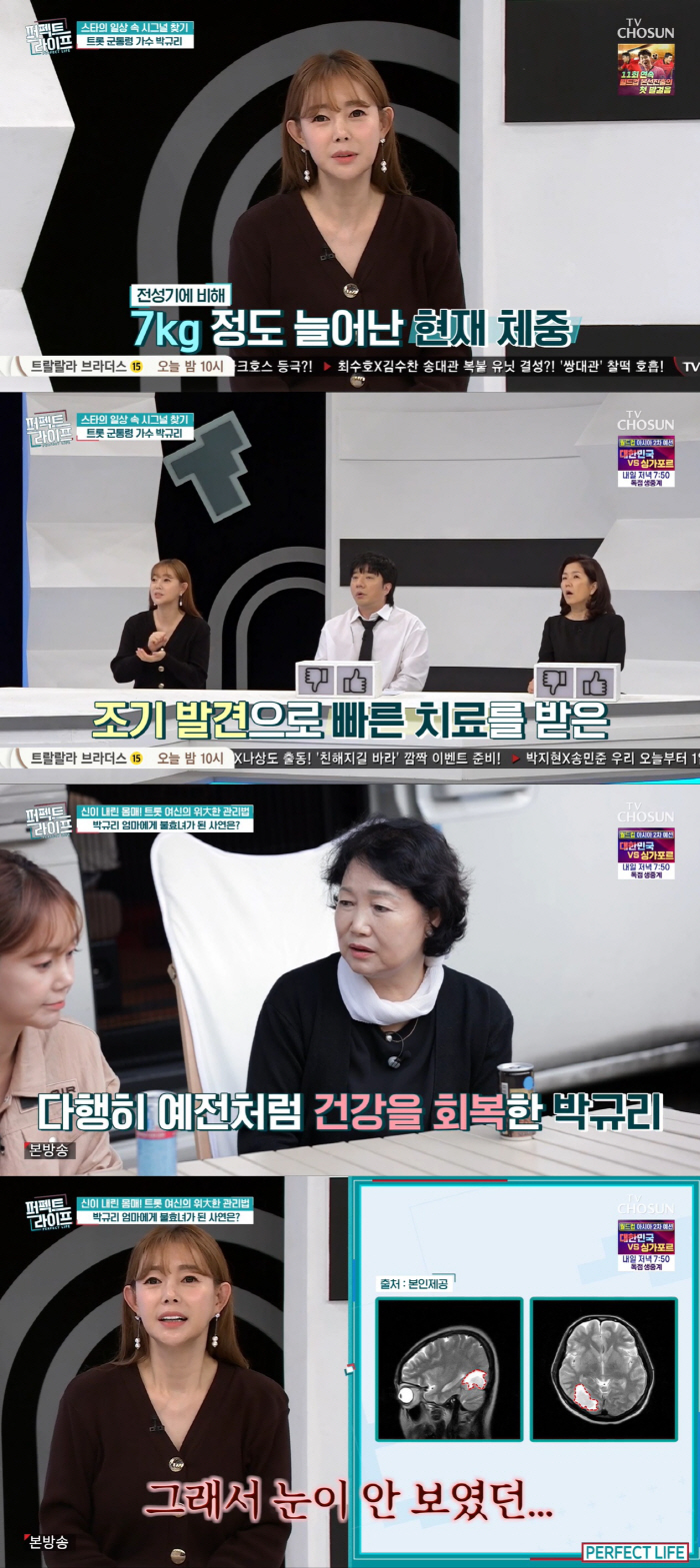 박규리, 뇌출혈 고백 "시신경 다쳐 눈 안 보여, 60kg까지 쪘다" (…