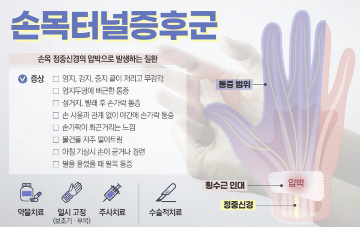 주부·사무직 괴롭히는 '손목터널증후군' 증상은?