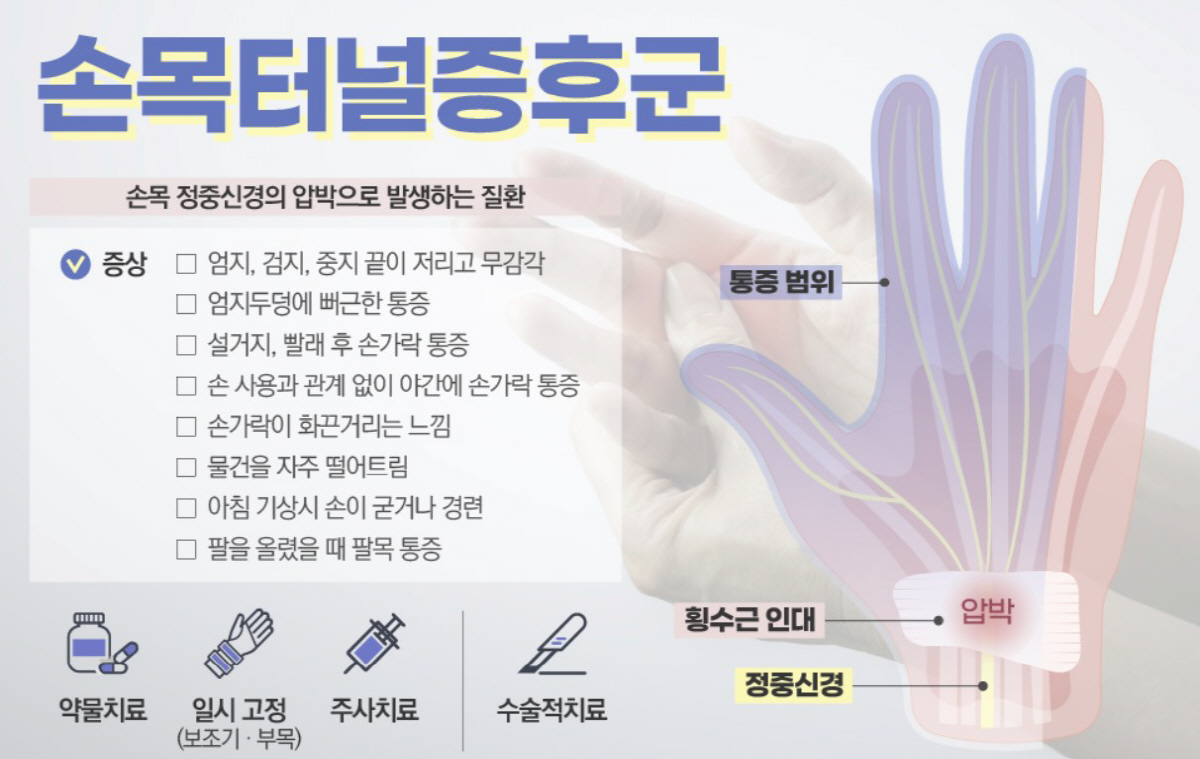주부·사무직 괴롭히는 '손목터널증후군' 증상은?