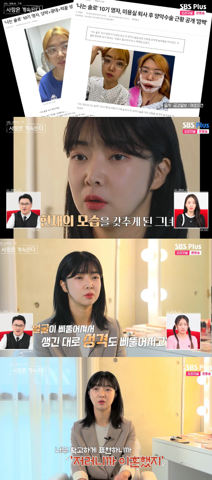 10기 영자, 악플 때문에 양악수술.."포털 1면 깜짝..♥연하 남친 교…