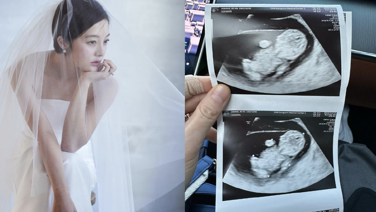 '난임 고백' 황보라, 결혼 1년만 임신 발표 "처음 느껴보는 사랑" […