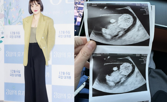 '김용건 며느리' 황보라, 결혼 1년만 임신 "아기천사 오덕이 고마워"