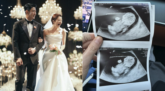 '난임 고백' 황보라, '시험관 4차' 임신 "처음 느껴보는 사랑"...…