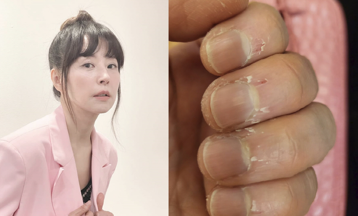 서정희 "손톱 보니 그야말로 가관"...유방암 투병 후 쉽지 않은 이사