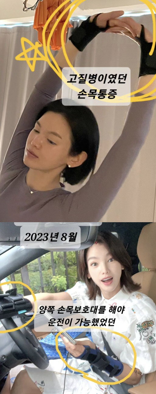 '싱글맘' 정가은 "다발성 염증→방아쇠수지로 고생, 손목 아파 수술 빼고…