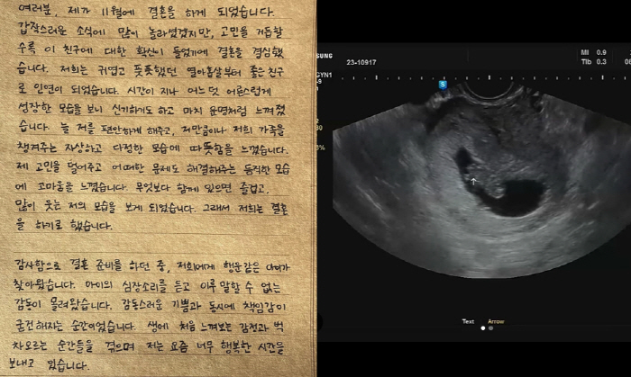 라붐 해인,♥남편과 진한 키스+설렘 눈빛...결혼+임신으로 2막 시작 […