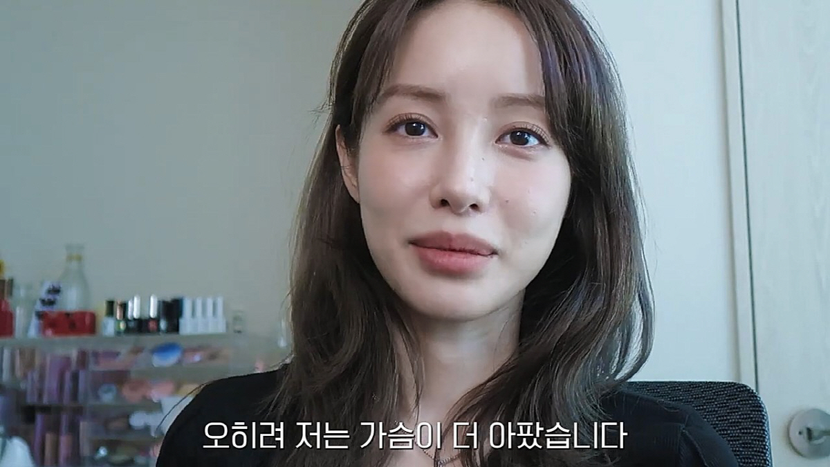 '최고기와 이혼' 유깻잎, 얼굴 윤곽수술 후기 공개.."가슴이 더 아팠다…