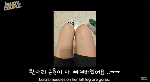 임라라, 무릎 인대 끊어졌다..."근육 빠지고 진물+이석증까지 고통"(엔…