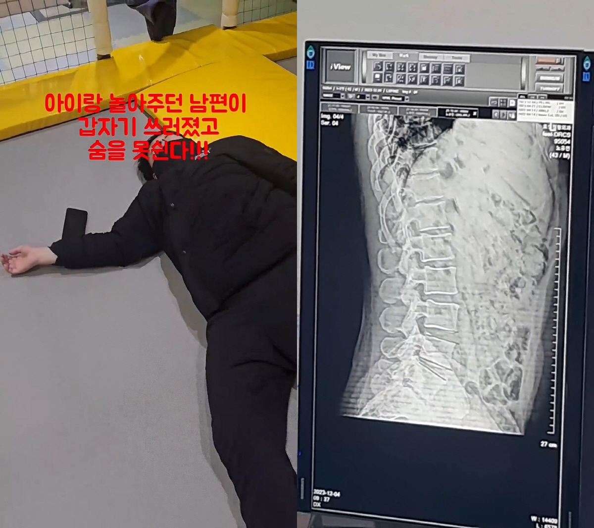 "이 상황에서 영상 찍었다고"..'혼절' 노유민♥아내 "정신돌아오고 난 …