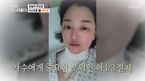 정미애 "설암 수술로 혀 1/3 절제...처음엔 웃지도 못했다"(마이웨이…