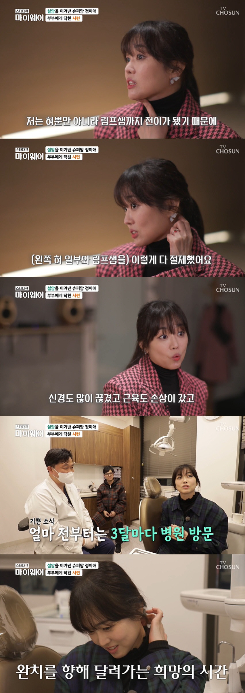 정미애 "설암, 림프샘까지 전이...혀 1/3 절제 후 신경 끊겨" ('…