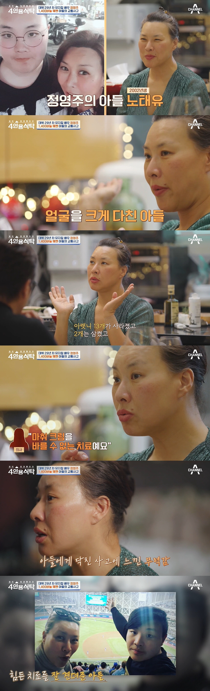 정영주 "子 교통사고로 눈 밑이 다 사라져..마취 없이 1400바늘 꿰매…