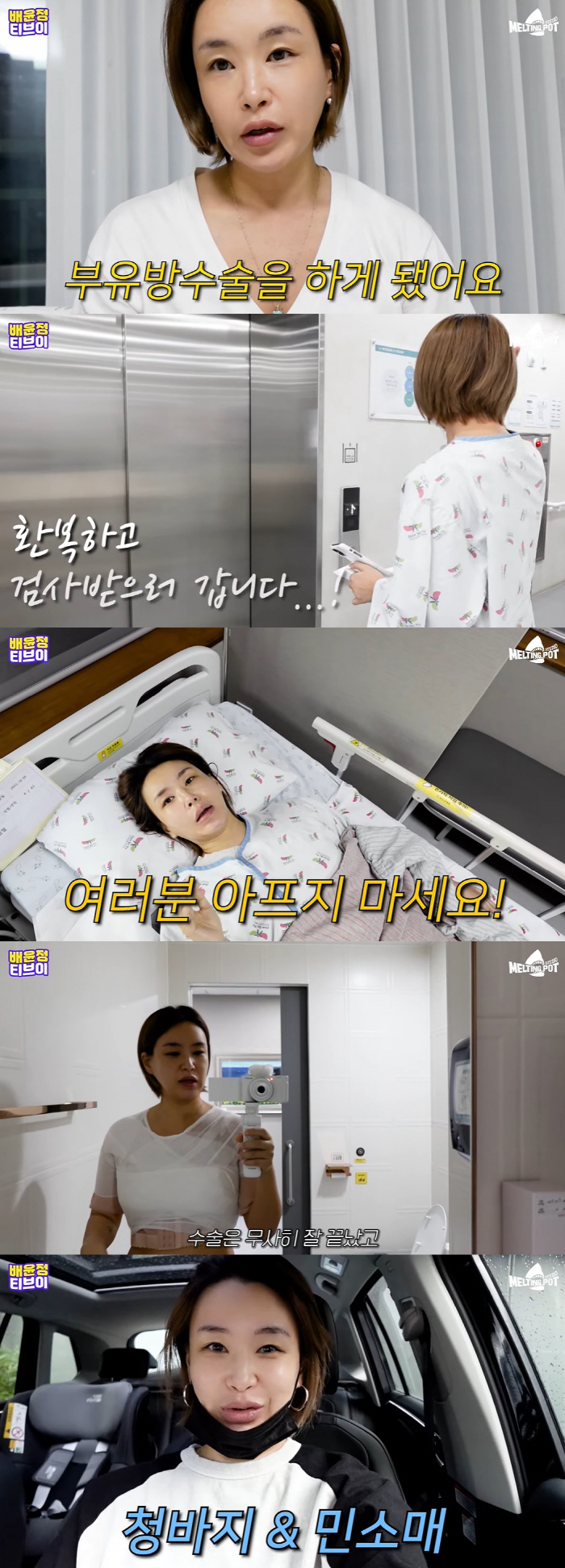 배윤정, 부유방 수술받았다 "전신마취 무서웠지만 할만해, 내년엔 민소매 …
