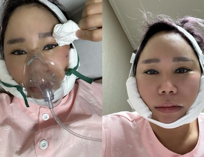 '강원래♥' 김송, 광대수술 후 여전히 퉁퉁 부은 얼굴 "입 벌릴 수 없…