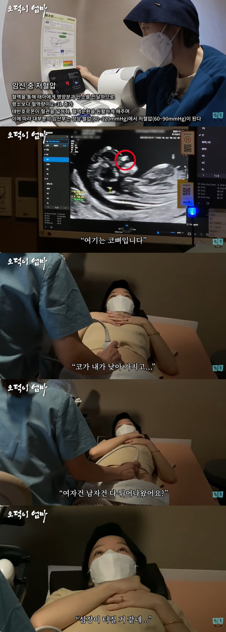 '김용건 며느리' 황보라, 아기 기형아 검사에 잔뜩 긴장 "심장 터질 거…