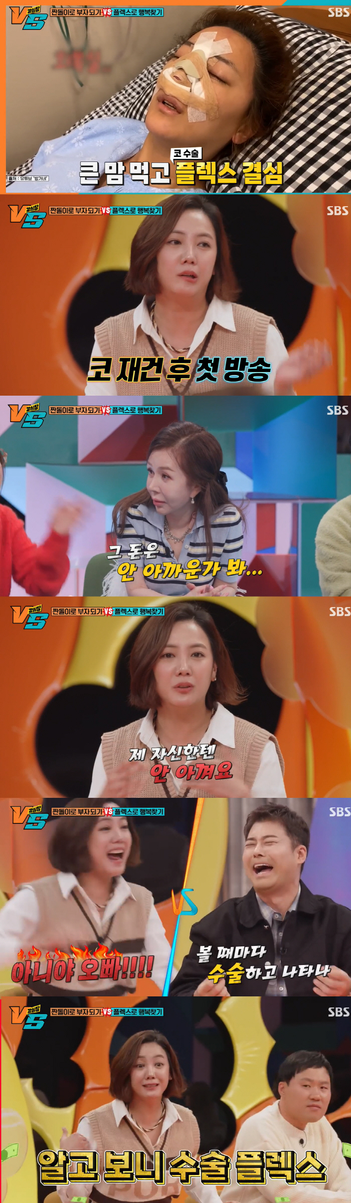 고은아, 9시간 코수술→모발 이식 "중형차 한대값, 내 몸에 플렉스"(강…