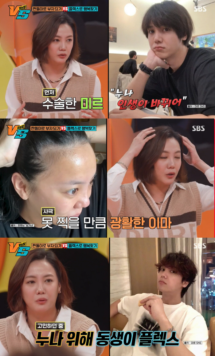고은아, 9시간 코수술→모발 이식 "중형차 한대값, 내 몸에 플렉스"(강…