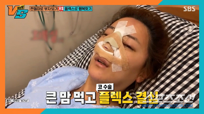 '한달 30만원 소비' 고은아, 코 재건 수술엔 중형차 한 대값…"수술 …
