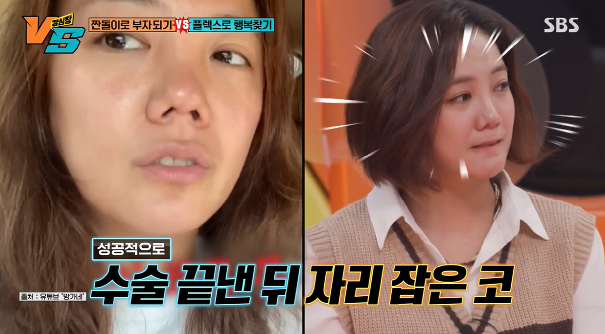 '더 이상 성형 NO' 고은아, 2차 코수술 하나 "이번엔 미용 목적"(…