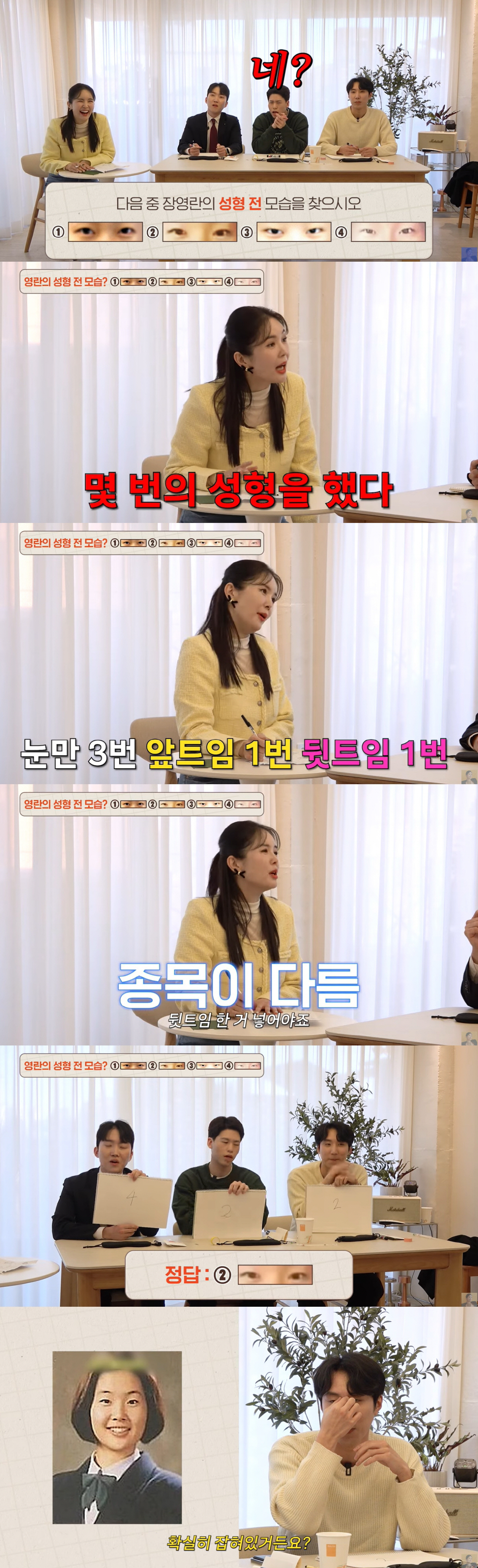 장영란, 매니저가 더 놀란 성형수술 횟수 "그렇게 많이 했냐" ('A급장…