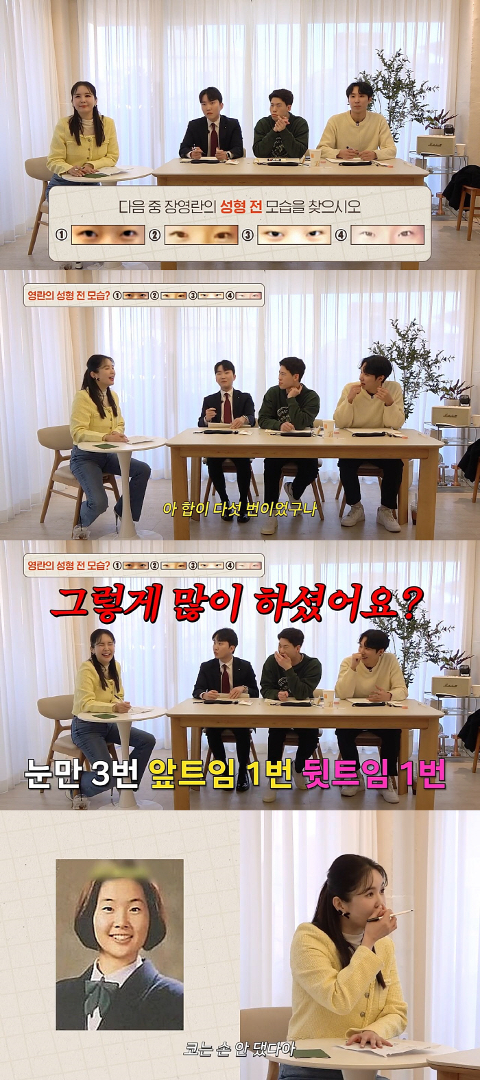 장영란 "눈만 3번, 앞트임 뒷트임 1번씩 총5번, 코는 손 안대"…성형…