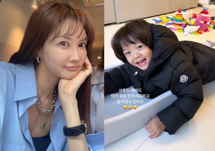 양미라, 15년 미룬 코 수술 받았다 "아이들, 엄마 얼굴 안 무서워해"
