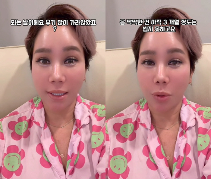 김송, '광대 수술' 악플에 분노 "내돈내산, ♥강원래도 뭐라 안 하는데…