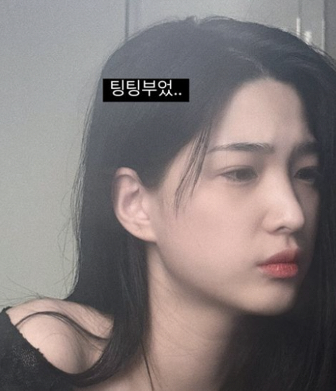 '이혼·양육권 포기' 율희, 삼남매 육아 대신 늦잠 "얼굴이 팅팅 부었어…