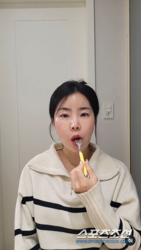 [SC이슈]'쌍밍아웃' 10기 영숙, 눈 붓기-피멍 고스란히 공개…"테이…