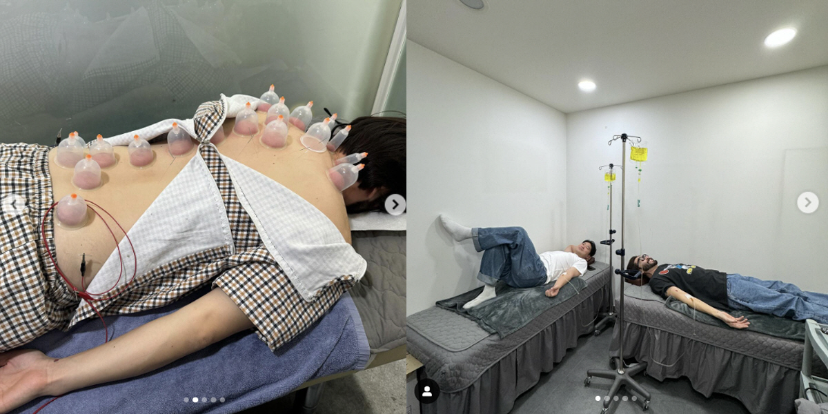 '지팡이 도보' 노홍철, 인생 첫 부항 치료 "최자와 병원行"