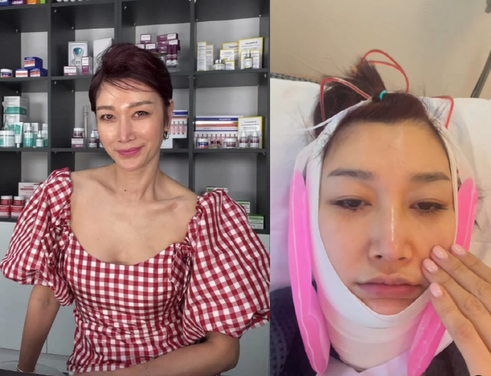 변정수, 12년만 갑상선암 수술 흉터 지웠다 "침도 삼키기 어려워"
