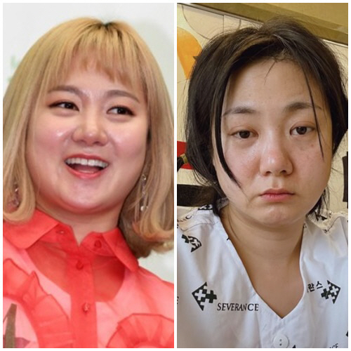 "저 괜찮아요!" 박나래, 성대수술→'나혼산' 불참…쏟아진 우려에 직접 …