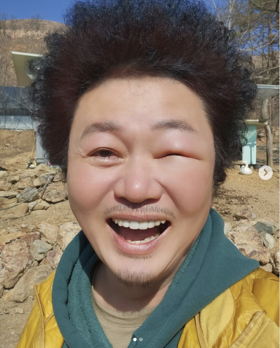 윤택 '자연인이다' 촬영중 긴급 사태 "이렇게 붓는다고?"