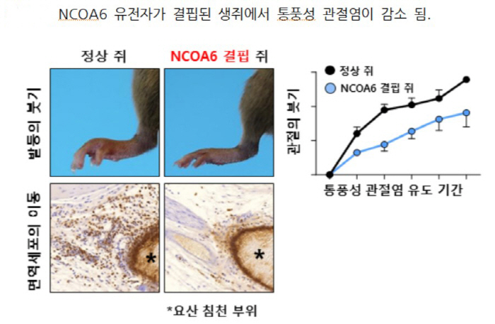 통풍성 관절염 발생 핵심 단백질 세계 최초 규명