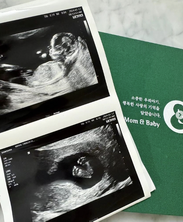 [SC이슈]저출산 시대에 애국…강재준♥이은형-조충현♥김민정, 한날 동시 …