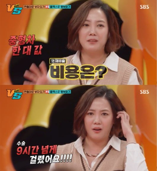 '36세' 고은아, '중형차 1대값' 코 재수술+12kg 감량 후 물오른…