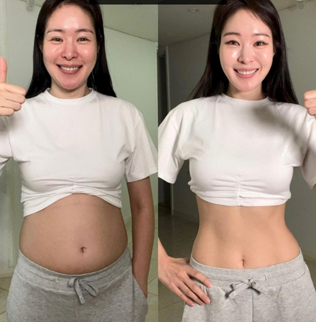 '김태현♥' 미자, 6일만 5kg 감량 성공..충격 뱃살→개미허리로 '변…