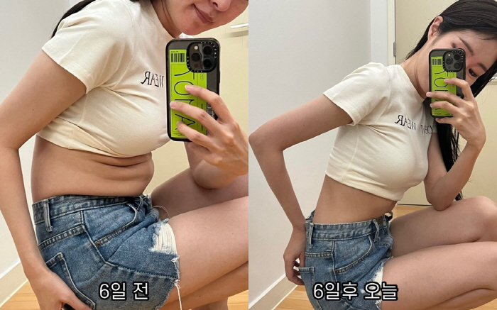 '김태현♥' 미자, 6일만 5kg 감량 성공..충격 뱃살→개미허리로 '변…